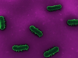 Le pouvoir pathogène d’une bactérie (ici, une salmonelle) dépend de trois éléments : la rapidité à laquelle elle se multiplie, sa capacité à produire des toxines et le pouvoir de résistance de la personne contaminée.