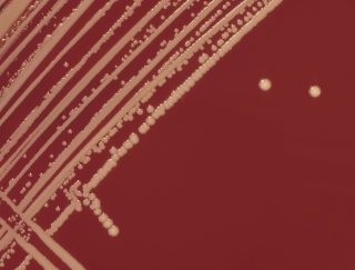 Le staphylocoque doré est une bactérie pathogène, qui produit une toxine responsable de troubles importants de la digestion.
