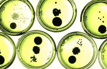 Analyses microbiologiques Analyses microbiologiques